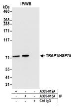 TRAP1/HSP75 Antibody in Immunoprecipitation (IP)