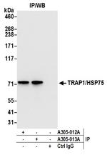 TRAP1/HSP75 Antibody in Immunoprecipitation (IP)