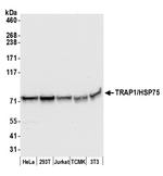 TRAP1/HSP75 Antibody in Western Blot (WB)