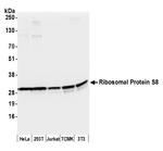 Ribosomal Protein S8/RPS8 Antibody in Western Blot (WB)