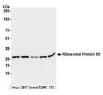 Ribosomal Protein S8/RPS8 Antibody in Western Blot (WB)