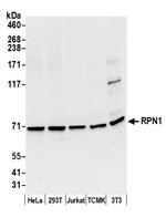 RPN1/Ribophorin I Antibody in Western Blot (WB)