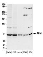 RPN1/Ribophorin I Antibody in Western Blot (WB)