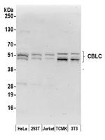 CBLC/CBL-3 Antibody in Western Blot (WB)