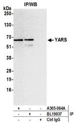 YARS/Tyrosyl-tRNA Synthetase/TYRRS Antibody in Immunoprecipitation (IP)