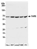 YARS/Tyrosyl-tRNA Synthetase/TYRRS Antibody in Western Blot (WB)