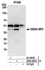 EBNA1BP2/EBNA1 Binding Protein 2/EBP2 Antibody in Immunoprecipitation (IP)