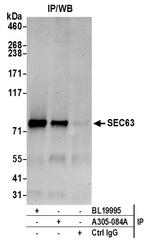 SEC63 Antibody in Immunoprecipitation (IP)