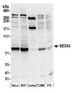 SEC63 Antibody in Western Blot (WB)