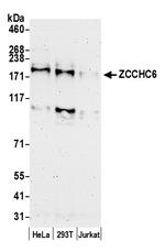 ZCCHC6 Antibody in Western Blot (WB)