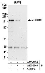 ZCCHC6 Antibody in Immunoprecipitation (IP)