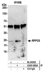 RPP25 Antibody in Immunoprecipitation (IP)