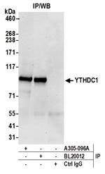 YTHDC1/YT521 Antibody in Immunoprecipitation (IP)