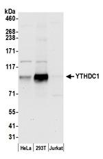 YTHDC1/YT521 Antibody in Western Blot (WB)