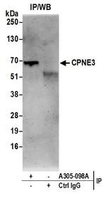 CPNE3/Copine 3 Antibody in Immunoprecipitation (IP)