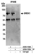 SREK1/SFRS12 Antibody in Immunoprecipitation (IP)