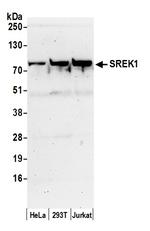 SREK1/SFRS12 Antibody in Western Blot (WB)