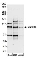 ZNF598 Antibody in Western Blot (WB)