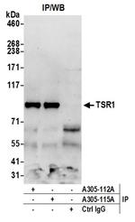 TSR1 Antibody in Immunoprecipitation (IP)