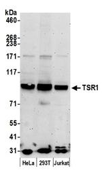 TSR1 Antibody in Western Blot (WB)