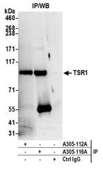 TSR1 Antibody in Immunoprecipitation (IP)