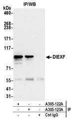 DIEXF/C1orf107 Antibody in Immunoprecipitation (IP)