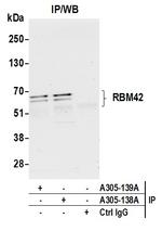 RBM42 Antibody in Immunoprecipitation (IP)