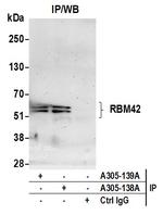 RBM42 Antibody in Immunoprecipitation (IP)