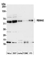 RBM42 Antibody in Western Blot (WB)