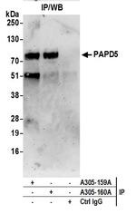 PAPD5/TRF4-2 Antibody in Immunoprecipitation (IP)