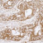 MVP/Major Vault Protein Antibody in Immunohistochemistry (Paraffin) (IHC (P))