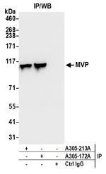 MVP/Major Vault Protein Antibody in Immunoprecipitation (IP)