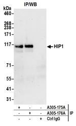 HIP1/Huntingtin-interacting Protein 1 Antibody in Immunoprecipitation (IP)