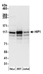 HIP1/Huntingtin-interacting Protein 1 Antibody in Western Blot (WB)