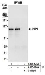 HIP1/Huntingtin-interacting Protein 1 Antibody in Immunoprecipitation (IP)