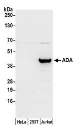 ADA/Adenosine Deaminase Antibody in Western Blot (WB)