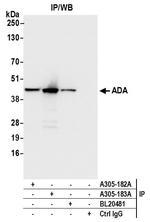 ADA/Adenosine Deaminase Antibody in Immunoprecipitation (IP)