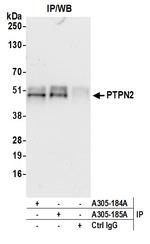 PTPN2/TCPTP Antibody in Immunoprecipitation (IP)