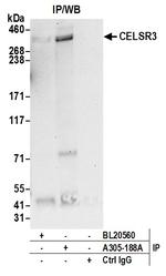 CELSR3/Flamingo Homolog 1 Antibody in Immunoprecipitation (IP)