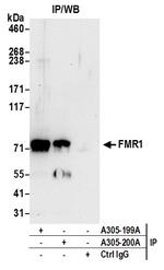 FMR1/FMRP Antibody in Immunoprecipitation (IP)