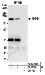 ITGB4/CD104/Integrin beta-4 Antibody in Immunoprecipitation (IP)