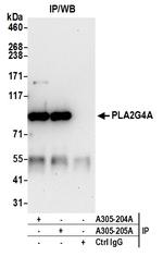 PLA2G4A/cPLA2 Antibody in Immunoprecipitation (IP)