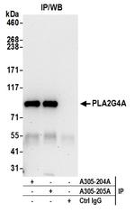 PLA2G4A/cPLA2 Antibody in Immunoprecipitation (IP)