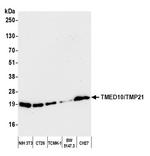 TMED10/TMP21 Antibody in Western Blot (WB)