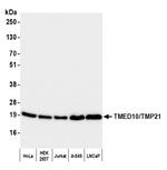 TMED10/TMP21 Antibody in Western Blot (WB)