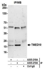 TMED10/TMP21 Antibody in Immunoprecipitation (IP)