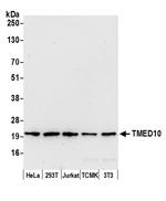 TMED10/TMP21 Antibody in Western Blot (WB)