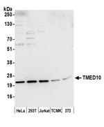 TMED10/TMP21 Antibody in Western Blot (WB)