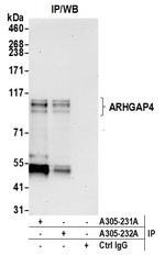 ARHGAP4 Antibody in Immunoprecipitation (IP)