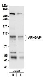 ARHGAP4 Antibody in Western Blot (WB)